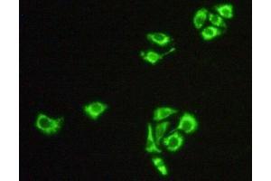 Detection of Hsp60 in Hela cells using Polyclonal Antibody to Heat Shock Protein 60 (Hsp60) (HSPD1 抗体  (AA 316-573))