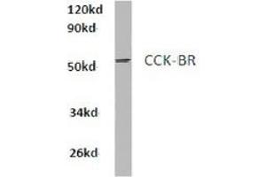Image no. 1 for anti-Cholecystokinin B Receptor (CCKBR) antibody (ABIN317856) (CCKBR 抗体)