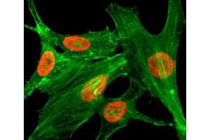 ICC/IF staining of HeLa cells treated with sodium butyrate using recombinant H2A. (Recombinant H2AFZ 抗体  (acLys4))