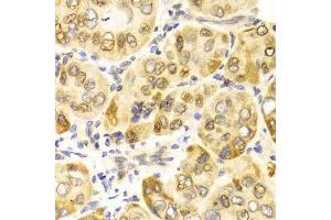 Immunohistochemistry (IHC) image for anti-Carnitine Palmitoyltransferase 2 (CPT2) antibody (ABIN3023425) (CPT2 抗体)