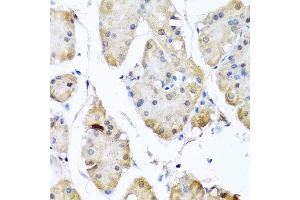 Immunohistochemistry of paraffin-embedded human gastric using YAP1 antibody at dilution of 1:100 (x40 lens). (YAP1 抗体)