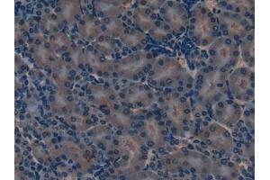 Detection of SOD2 in Mouse Kidney Tissue using Polyclonal Antibody to Superoxide Dismutase 2, Mitochondrial (SOD2) (SOD2 抗体  (AA 25-222))
