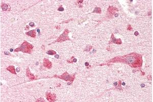 Immunohistochemistry (IHC) image for anti-Prostaglandin E Synthase 2 (PTGES2) (AA 292-306) antibody (ABIN5539612)