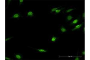 Immunofluorescence of monoclonal antibody to HNF4A on HeLa cell. (HNF4A 抗体  (AA 324-423))