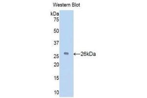 Western Blotting (WB) image for anti-Vitamin D-Binding Protein (GC) (AA 205-403) antibody (ABIN1078667) (Vitamin D-Binding Protein 抗体  (AA 205-403))