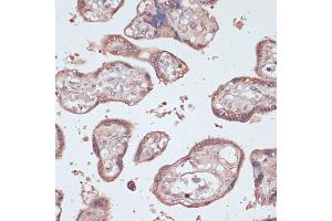 Immunohistochemistry of paraffin-embedded human placenta using GEMIN5 antibody (ABIN7267367) at dilution of 1:100 (40x lens). (GEMIN5 抗体  (AA 750-950))