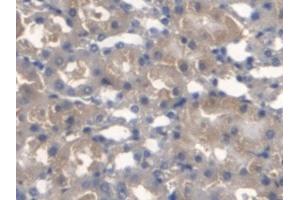 Detection of TMEM27 in Mouse Kidney Tissue using Monoclonal Antibody to Transmembrane Protein 27 (TMEM27) (TMEM27 抗体  (AA 12-222))