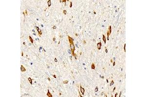 Immunohistochemistry (Paraffin-embedded Sections) (IHC (p)) image for anti-NAC alpha Domain Containing (NACAD) antibody (ABIN7074756)