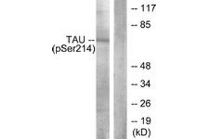 Western blot analysis of extracts from HeLa cells, using Tau (Phospho-Ser214) Antibody. (tau 抗体  (pSer531))