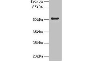 Western blot All lanes: SLC46A3 antibody at 4 μg/mL + Jurkat whole cell lysate Secondary Goat polyclonal to rabbit IgG at 1/10000 dilution Predicted band size: 52, 43 kDa Observed band size: 52 kDa (SLC46A3 抗体  (AA 26-73))