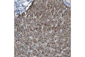 Immunohistochemical staining of human liver with SVOPL polyclonal antibody  shows moderate cytoplasmic positivity in hepatocytes at 1:50-1:200 dilution. (SVOPL 抗体)