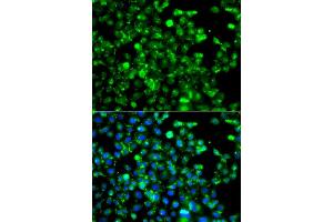 Immunofluorescence analysis of A549 cells using CAPN5 antibody (ABIN5975527). (Calpain 5 抗体)