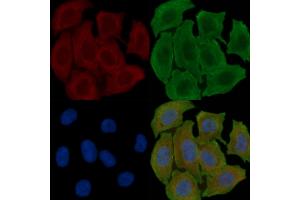 ABIN6262117 and ABIN6278010 staining Hela cells(30 min of UV treatment) by IF/ICC.