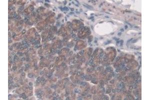Immunohistochemistry (IHC) image for anti-Asporin (ASPN) (AA 16-373) antibody (ABIN7434827)