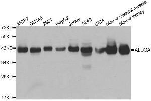 Western blot analysis of extracts of various cell lines, using ALDOA antibody. (ALDOA 抗体)