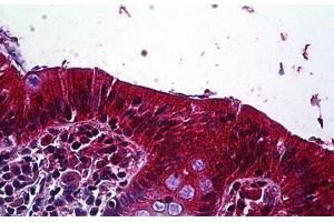 Human Colon, Epithelium: Formalin-Fixed, Paraffin-Embedded (FFPE) (LRP4 抗体  (AA 1765-1777))