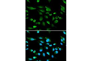 Immunofluorescence analysis of A549 cell using AIRE antibody. (AIRE 抗体)