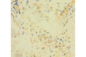 Immunohistochemistry of paraffin-embedded human placenta tissue using ABIN7144701 at dilution of 1:100 (Arylsulfatase I 抗体  (AA 301-569))