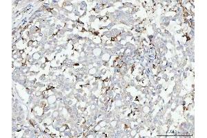 IHC analysis of CD14 using anti-CD14 antibody (ABIN3044565). (CD14 抗体  (AA 65-327))