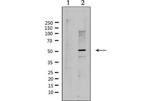 Western blot analysis of extracts from Hela, using RAD51L2 Antibody.