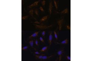 Immunofluorescence analysis of U-2 OS cells using UCP4 antibody (ABIN6132767, ABIN6147925, ABIN6147927 and ABIN6217968) at dilution of 1:100. (SLC25A27 抗体  (AA 1-245))