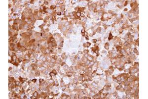 IHC-P Image Immunohistochemical analysis of paraffin-embedded CL1-0 xenograft, using NQO1, antibody at 1:500 dilution. (NQO1 抗体  (C-Term))