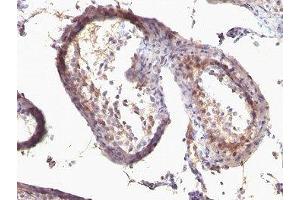 Formalin-fixed, paraffin-embedded human testicular carcinoma stained with anti-TGF alpha antibody (SPM542) (TGFA 抗体  (AA 34-43))