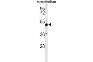 Western blot analysis of ANKH Antibody (C-term) in mouse cerebellum tissue lysates (35ug/lane). (ANKH 抗体  (C-Term))