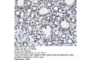 Rabbit Anti-AIRE Antibody  Paraffin Embedded Tissue: Human Kidney Cellular Data: Epithelial cells of renal tubule Antibody Concentration: 4. (AIRE 抗体  (N-Term))