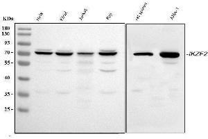 Western blot analysis of IKZF2 using anti-IKZF2 antibody (ABIN7599427).