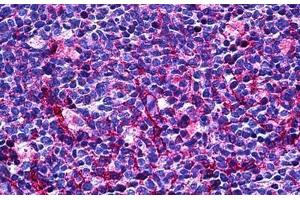 Human Tonsil: Formalin-Fixed, Paraffin-Embedded (FFPE) (CD31 抗体  (AA 686-735))