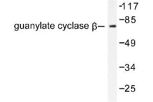 Image no. 1 for anti-Guanylate Cyclase 1, Soluble, beta 3 (GUCY1B3) antibody (ABIN265451) (GUCY1B3 抗体)