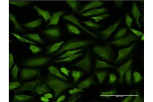 Immunofluorescence of monoclonal antibody to STIP1 on HeLa cell. (STIP1 抗体  (AA 445-543))