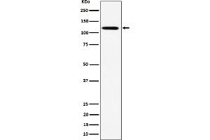 Western blot analysis of KIF5B expression in HeLa cell lysate. (Recombinant KIF5B 抗体)