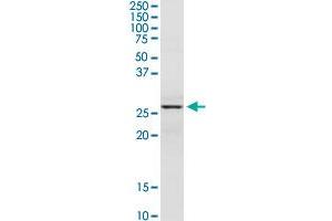 DCI MaxPab rabbit polyclonal antibody. (DCI 抗体  (AA 1-243))