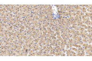 Detection of FTH in Human Liver Tissue using Monoclonal Antibody to Ferritin, Heavy Polypeptide (FTH) (FTH1 抗体  (AA 1-183))