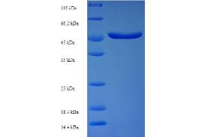 SDS-PAGE (SDS) image for Cyclin-Dependent Kinase Inhibitor 1A (p21, Cip1) (CDKN1A) (AA 425-719), (partial) protein (His-SUMO Tag) (ABIN5711920)