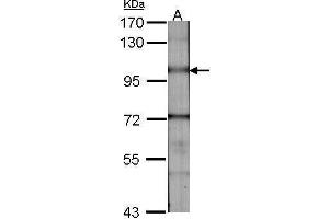 WB Image Sample (30 ug of whole cell lysate) A:NIH-3T3 7. (BMPR2 抗体  (C-Term))