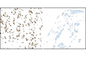 Immunocytochemistry (ICC) image for anti-Ubiquitin Carboxyl-terminal Esterase L1 (Ubiquitin Thiolesterase) (UCHL1) (AA 50-100) antibody (ABIN7449527)