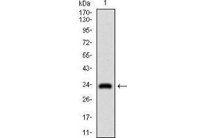 Western blot analysis using GSC mAb against human GSC recombinant protein. (GSC 抗体  (AA 191-257))