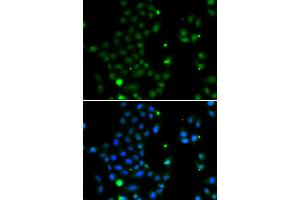 Immunofluorescence analysis of MCF-7 cells using GCM1 antibody (ABIN5974384). (GCM1 抗体)