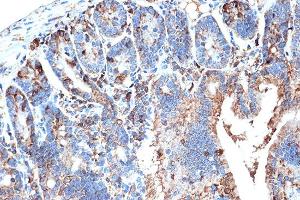 Immunohistochemistry of paraffin-embedded mouse intestin using FABPI Rabbit mAb (ABIN7267151) at dilution of 1:100 (40x lens). (FABP2 抗体)