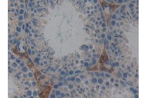 Detection of GSTt2 in Mouse Testis Tissue using Polyclonal Antibody to Glutathione S Transferase Theta 2 (GSTt2) (GSTT2 抗体  (AA 15-216))