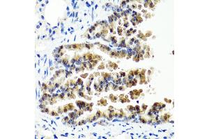 Immunohistochemistry of paraffin-embedded mouse lung using SIRT1 antibody (ABIN5970059) at dilution of 1/100 (40x lens). (SIRT1 抗体  (C-Term))