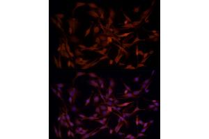 Immunofluorescence (IF) image for anti-Aldo-Keto Reductase Family 1, Member B1 (Aldose Reductase) (AKR1B1) (AA 1-316) antibody (ABIN3022391)