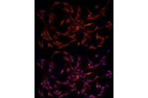 Immunofluorescence analysis of PC-12 cells using B1 Rabbit pAb (ABIN3022390, ABIN3022391, ABIN3022392, ABIN1512555 and ABIN6218779) at dilution of 1:50 (40x lens). (AKR1B1 抗体  (AA 1-316))
