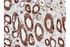 Immunohistochemistry (IHC) image for anti-Sec1 Family Domain Containing 1 (SCFD1) antibody (ABIN1500818)
