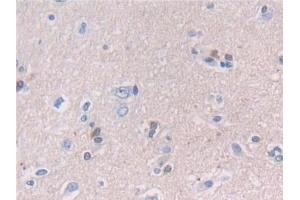 Detection of NCAM2 in Human Cerebrum Tissue using Polyclonal Antibody to Neural Cell Adhesion Molecule 2 (NCAM2) (NCAM2 抗体  (AA 21-297))