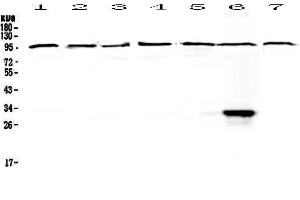 Western blot analysis of DGCR8 using anti-DGCR8 antibody . (DGCR8 抗体  (AA 561-762))