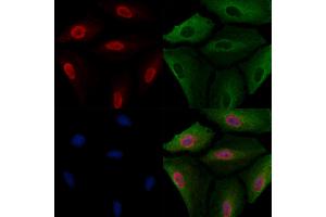 ABIN6264373 and ABIN6277684 staining  cells by IF/ICC. (PPARD 抗体  (C-Term))